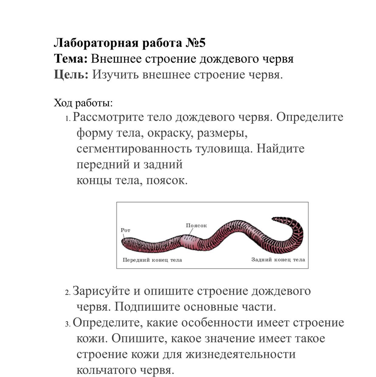 Передний и задний конец червя. Внешнее строение передний конец дождевой червь. Подпиши части тела дождевого червя. Изучение внешнего строения дождевого червя лабораторная. Особенности строения кожи дождевого червя.
