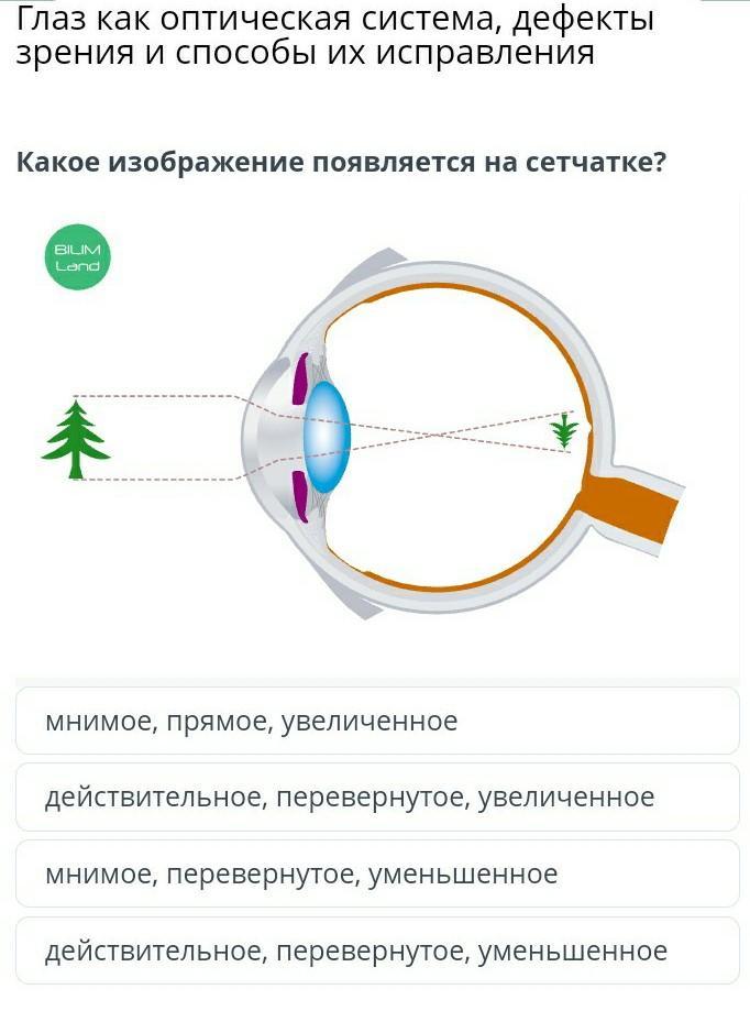 К оптической системе глаза относятся. Оптическая система глаза. Глаз как оптическая система. Устройство глаза как оптической системы. Глаз строение и дефекты зрения.